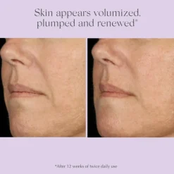 Age Reverse Advanced Total Correct Serum 30ml