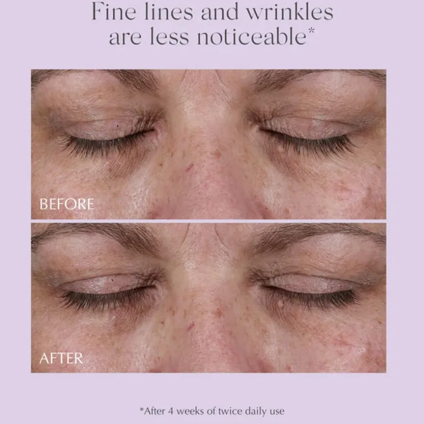 Age Reverse Total 360 Eye Contour 15g