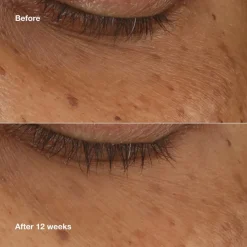 All About Eyes Brightening Serum Concentrate 10ml