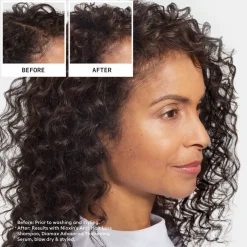 Anti Hairloss Shampoo 240ml