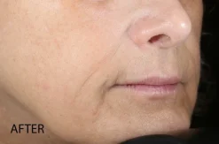 Biolumin-C Serum 59ml