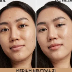 Bye Bye Dark Spots Concealer + Serum Medium Neutral 31 6,7ml