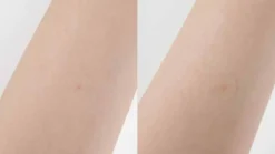 Clear Skin Shield Patch Set