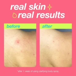 Clear Start Clarifying Body Spray 177ml