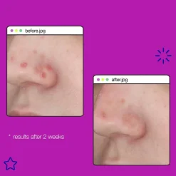 Clear Start Post-Breakout Fix 15ml