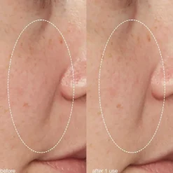 Daily Liquid Peelfoliant 59ml