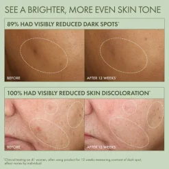 Dr. Weil Mega-Mushroom Dark Spot Corrector Serum 50ml