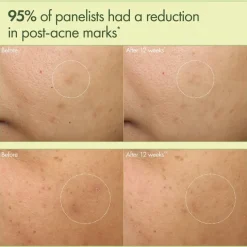 Dr. Weil Mega-Mushroom Dark Spot Correcting Brightening Moisturizer 50ml