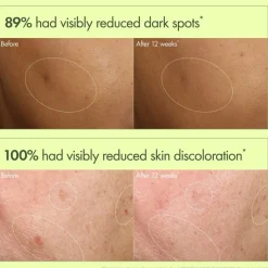 Dr. Weil Mega-Mushroom Dark Spot Correcting Brightening Serum 30ml