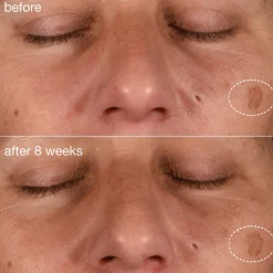 Dynamic Skin Recovery SPF50 15ml