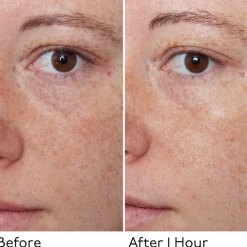 Hyaluronic Global Face Cream 50ml