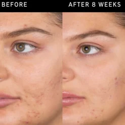 INKEY Salicylic Acid Cleanser 60ml