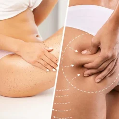 Niacin Cellulite Scrub Extra-Firming Organic Coconut Sugar & Talasso Body Exfoliator 250ml