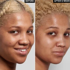 Niacinamide Serum 30ml