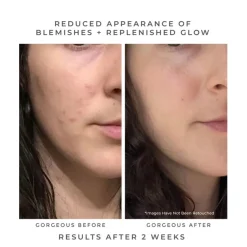 Oasis Deep Pore Gel Cleanser 60ml