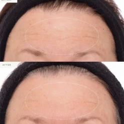 Plant Stem Cell Retinol Alternative Serum 30ml