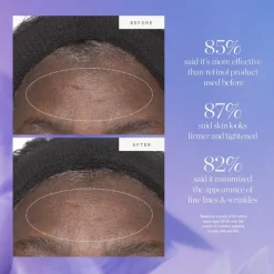 Plant Stem Cell Retinol Alternative Moisturizer 15ml