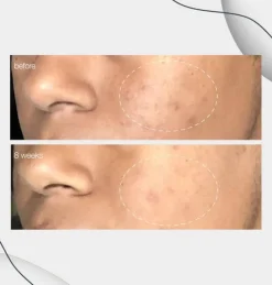 PowerBright Dark Spot Serum 30ml