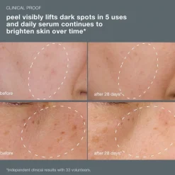 PowerBright Dark Spot System