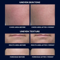 Retinol Fusion Pm Serum 30ml