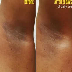 Rio Deo 40 Deodorant Refill 57g