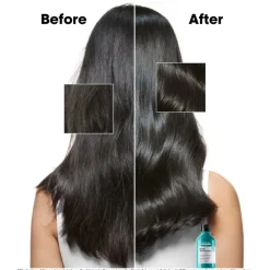 Scalp Advanced Anti-Dandruff Shampoo 300ml