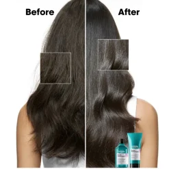 Scalp Advanced Anti-Discomfort Shampoo 300ml