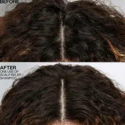 Scalp Relief Dandruff Control Shampoo 250ml