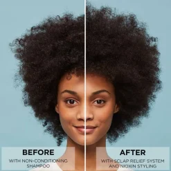 Scalp Relief Serum 100ml