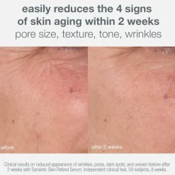 Skin Aging Solutions Set