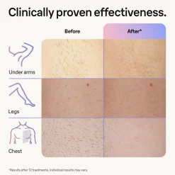 Skin I-Expert Pro IPL PL7147