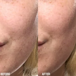 Skin Renewal Serum 25ml