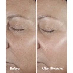 Smart Clinical Repair Wrinkle Correcting Serum 50ml