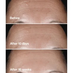 Smart Clinical Repair Wrinkle Correcting Serum 50ml