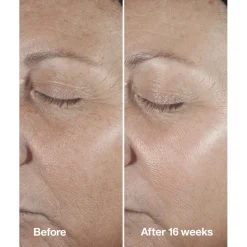 Smart Clinical Repair Wrinkle Correcting Serum 30ml