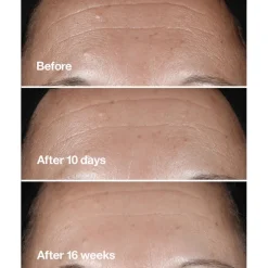 Smart Clinical Repair Wrinkle Correcting Serum 30ml