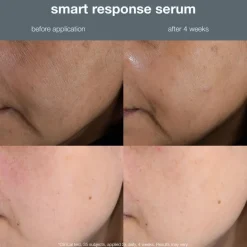 Smart Response Serum Set