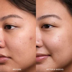 Transform Dewtopia 20% Acid Night Treatment 30ml