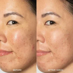 Transform Glow2OH Dark Spot Toner 190ml