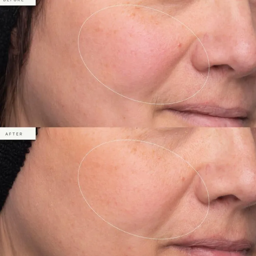 Turmeric Glow Moisturizer 50ml