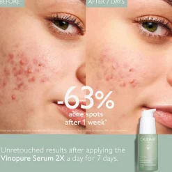 Vinopure Blemish Control Infusion Serum 30ml