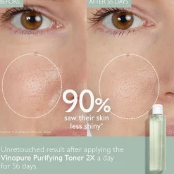 Vinopure Clear Skin Purifying Toner 200ml