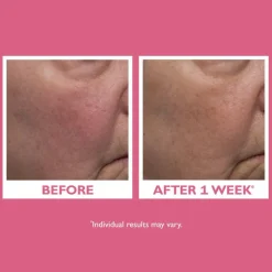 Vital-E Microbiome Age Defense Cream 50ml