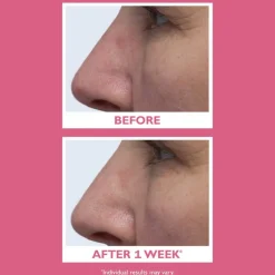 Vital-E Microbiome Age Defense Cream 50ml